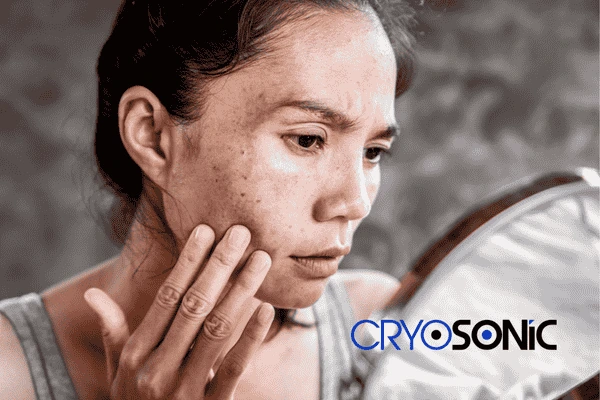Book your sun damaged skin treatment online today in Oxford