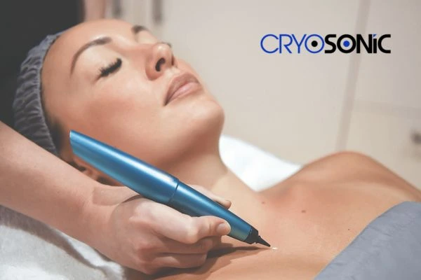 Cryosonic lesion removal prices book today! Oxford